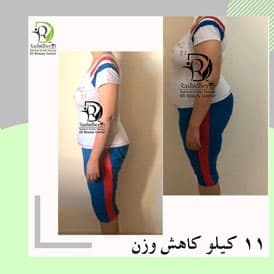 نتیجه رژیم پرشنگ حیدری