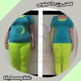 نتیجه رژیم ستاره میرزایی